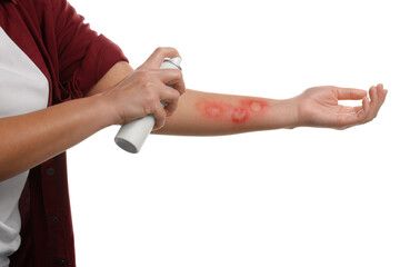 Canvas Print - Woman applying panthenol onto burned hand on white background, closeup