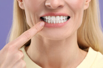 Sticker - Woman showing her clean teeth on violet background, closeup view