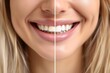 © LimeSky - Smiling woman seeks dental care for teeth whitening