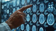 © JMarques - Close-up of a doctor's hand pointing out the diagnosis of a patient with Alzheimer's on a brain scan. Health care and neurology concept.