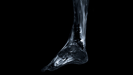 Poster - mri foot scan sagittal view t2 fat suppression technique for diagnostic tendon injury.
