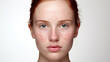 Beautiful young girl with red hair, freckles and problematic skin with redness.