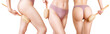 © Galaxy_love_design - Collage woman uses exfoliating brush on legs and buttocks.