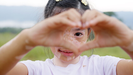 Wall Mural - Little cute alpha young albino vitiligo small girl relax smile give heart hand sign look at camera. Melanin face body care hair color of asia people gen z kid self love happy proud of diverse skin.