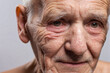 © Giuseppe Cammino - Close-up on face skin of old man, skin exfoliation, dry skin concept
