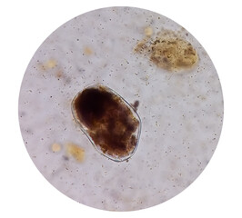 Poster - Giardia lamblia cysts and Trophozoite form, muscle fiber in stool examination, under 40X light microscope, selective focus.