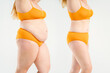 © staras - Tummy tuck, woman's fat body before and after weight loss and liposuction on gray background, plastic surgery concept