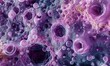 Cimitis spherules found in skin biopsy