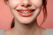 © Oksana - Closeup of smiling woman mouth with dental braces