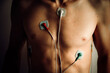 Heart monitor, EKG, cardio recording placed on the body of a young man. A medical tool for monitoring heart rate and overall heart health. Electrocardiogram in natural light