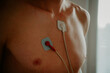 Cardio health revealed: Natural light illuminates the intricate patterns of an EKG on the physique of a youth