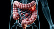Human Digestive System with colon Cancer and metastasis Illustration