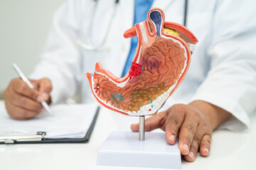 Stomach disease, doctor with human anatomy model for study diagnosis and treatment in hospital.