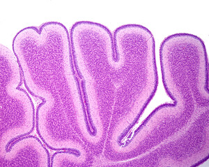 Canvas Print - Immature cerebellum. External granular layer