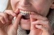© Demetr White/Stocksy - White woman wears transparent dental aligners