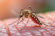 Close-up of a mosquito on human skin highlighting a nuisance for social media. Generative Ai