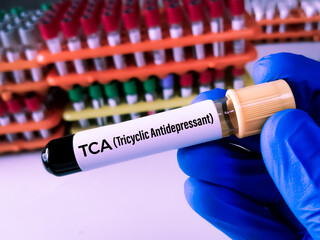 Wall Mural - Blood sample for Tricyclic antidepressant drug test.