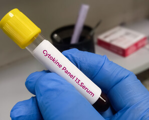 Sticker - Blood sample for Cytokine test, used to pathophysiology of immune, infectious, or inflammatory disorders. Cytokine Release Syndrome.