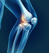 X-ray image showing the kneecap