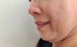 portrait the flabbiness and wrinkle beside the mouth, dark spots and loose, Flabby skin and dullness on the face of the woman, health care and beauty concept.