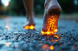 Legs burning in fire, heel spur, woman's leg hurts, pain in the foot, skin diseases, female feet with dry cracked skin close-up