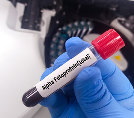 Sticker - Blood sample for Alpha-fetoprotein total (AFP) testing, tumor or cancer marker test for liver.