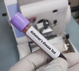 Sticker - Blood sample for ATN (Amyloid-Tau-Neurodegeneration) profile test, to diagnosis of Alzheimer's disease. Alzheimer's test.