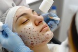 Fototapeta  - 
Photo of a person undergoing acne treatment, showcasing skincare products and topical medications