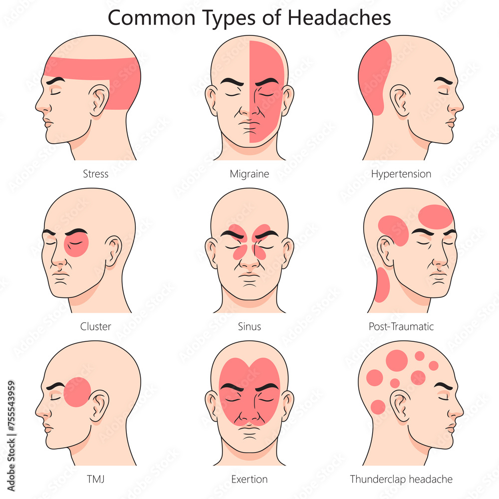 Human headache type structure diagram hand drawn schematic raster ...