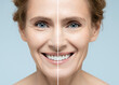 © Peakstock - Woman's face before and after skin tightening and anti-aging procedures. Remove of wrinkles, nasolabial folds, skin rejuvenation procedure