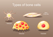Types of bone cells. Osteocyte, lining cells, osteoblast, osteoclast