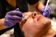 Photo of a young woman receiving a facial treatment for acne, such as microdermabrasion or chemical peels.