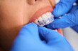 Close up of woman getting orthodontic teeth aligner at dentist's office.