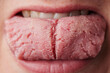 © Joel Forsman/Stocksy - this is what your tongue says about you