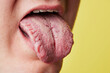 © Joel Forsman/Stocksy - this is what your tongue says about you