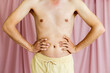 © Moy Ortega/Stocksy - Close-up of the nude torso of a very thin man squeezing his stomach