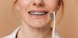 Close-up female in braces holding a toothbrush on a beige background