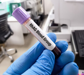 Poster - Technician hold blood sample for RhAG (Rh-associated glycoprotein) blood group testing. RHAG gene test.