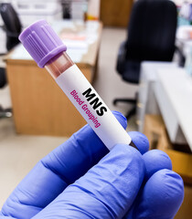 Poster - Technologist hold blood sample for MNS blood group system. Sugar-bearing proteins called glycophorins.