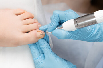 Wall Mural - Pedicure expert utilizes an electric drill machine to perform a professional hardware pedicure on female toenails.