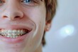Teen's Cheerful Braces Close-Up