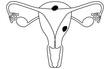© TKM - Illustrative illustrations of Endometrial cancer, anatomy of the uterus and ovaries