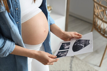 Wall Mural - Young pregnant woman with sonogram image in kitchen, closeup