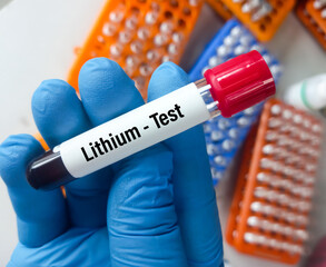 Sticker - Blood sample for Lithium level test, to determine the therapeutic level when just starting lithium medication or to determine lithium toxicity, Medical concept.