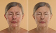 © New Africa - Aging skin changes. Collage with photos of mature woman before and after cosmetic procedure on beige background