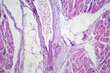 Cardiac hypertrophy, light micrograph
