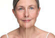 © New Africa - Aging skin changes. Collage with photos of mature woman before and after cosmetic procedure on white background