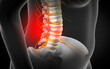 © Science RF - Spinal disc herniation, illustration