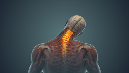 Wall Mural - Medical animation for neck pain