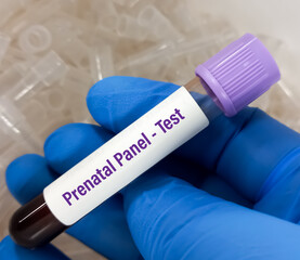 Poster - Blood sample for Prenatal panel test for pregnant women. Down syndrome. Disorder of the chromosomes.